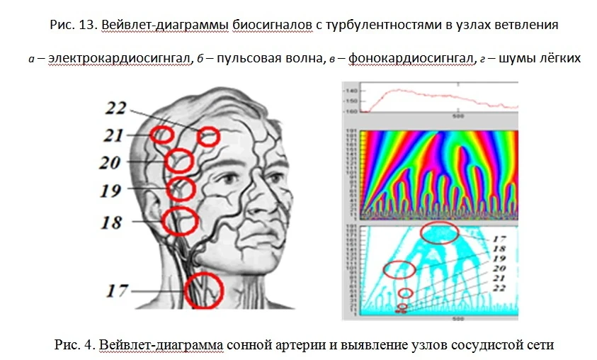 Новый метод диагностики даёт врачам новые возможности. вейвлет.jpg