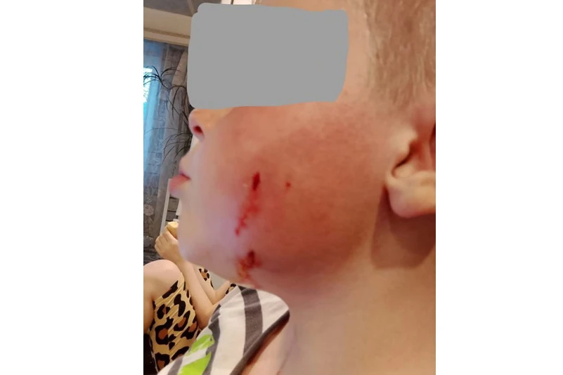 В Омске собака напала на 8-летнего мальчика
